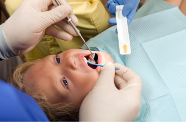 Fluoride varnish dental