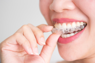 Invisalign clear aligners